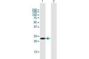 Western Blot analysis of ANKRD7 expression in transfected 293T cell line by ANKRD7 MaxPab polyclonal antibody. (ANKRD7 抗体  (AA 1-201))