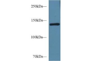 Detection of SEMA4D in Mouse Serum using Polyclonal Antibody to Semaphorin 4D (SEMA4D) (SEMA4D/CD100 抗体  (AA 502-636))