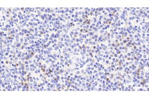 Detection of S100A12 in Human Spleen Tissue using Polyclonal Antibody to S100 Calcium Binding Protein A12 (S100A12) (S100A12 抗体  (AA 1-92))