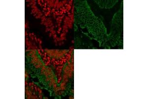Microarray (MA) image for anti-Epithelial Cell Adhesion Molecule (EPCAM) (AA 202-209), (Extracellular Domain) antibody (ABIN5646870)
