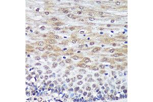Immunohistochemistry of paraffin-embedded Human esophageal using PSME4 Rabbit pAb  at dilution of 1:100 (40x lens). (PSME4 抗体  (AA 1634-1843))
