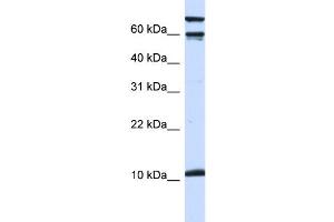 WB Suggested Anti-GAL Antibody Titration:  0. (GAL 抗体  (Middle Region))