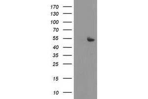 Western Blotting (WB) image for anti-Sedoheptulokinase (SHPK) antibody (ABIN1500920) (SHPK 抗体)