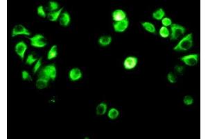 Detection of VIM in MCF7 cells using Polyclonal Antibody to Vimentin (VIM) (Vimentin 抗体  (AA 2-466))
