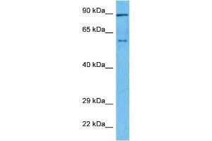 Host:  Rabbit  Target Name:  TOX  Sample Type:  Ovary Tumor lysates  Antibody Dilution:  1. (TOX 抗体  (Middle Region))