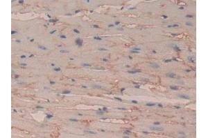 Immunohistochemistry (IHC) image for anti-Basigin (Ok Blood Group) (BSG) (AA 59-321) antibody (ABIN7440611)