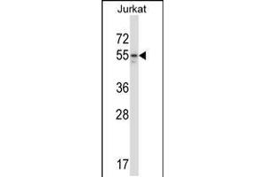 Western blot analysis in Jurkat cell line lysates (35ug/lane). (MAP2K7 抗体  (AA 206-233))