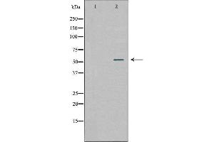 Western blot analysis of extracts from 293 cells, using WASF2 antibody. (WASF2 抗体  (Internal Region))