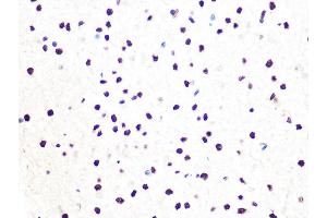 Immunohistochemistry of paraffin-embedded rat brain using DDB1 Rabbit mAb (ABIN7266673) at dilution of 1:100 (40x lens). (DDB1 抗体)