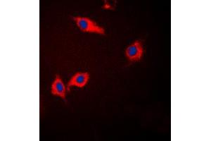 Immunofluorescent analysis of CK1 alpha staining in Jurkat cells. (CSNK1A1 抗体  (Center))