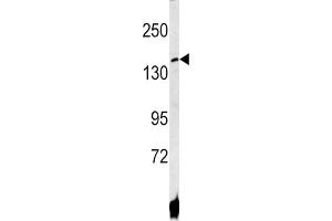 Western Blotting (WB) image for anti-ATPase, Cu++ Transporting, beta Polypeptide (ATP7B) antibody (ABIN3002647) (ATP7B 抗体)