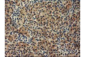 Immunohistochemical staining of paraffin-embedded Human pancreas tissue using anti-TBC1D21 mouse monoclonal antibody. (TBC1D21 抗体)