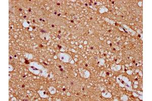 IHC image of ABIN7168823 diluted at 1:100 and staining in paraffin-embedded human brain tissue performed on a Leica BondTM system. (SEMA6B 抗体  (AA 756-888))