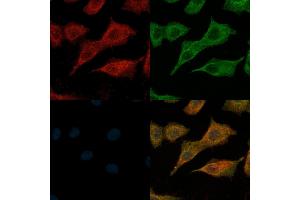 ABIN6260340 and ABIN6269120 staining  cells(H2O2 treatment) by IF/ICC.