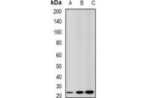 Western blot analysis of GSTA2 expression in mouse liver (A), mouse testis (B), rat kidney (C) whole cell lysates. (GSTa2 抗体)
