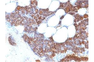 Formalin-fixed, paraffin-embedded human Parathyroid Gland stained with PTH-Monospecific Recombinant Rabbit Monoclonal Antibody (PTH/2295R). (Recombinant PTH 抗体  (AA 32-115))