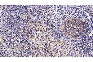 Immunohistochemistry (IHC) image for anti-Annexin A1 (ANXA1) (AA 208-336) antibody (ABIN7437599)
