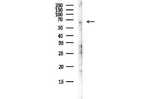 anti-Regulatory Factor X 5 (RFX5) antibody