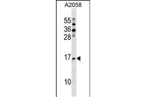 Western blot analysis in A2058 cell line lysates (35ug/lane). (NAT5 抗体  (C-Term))