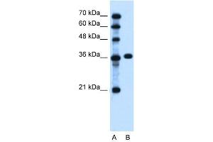 WB Suggested Anti-PTCH1 Antibody Titration:  0. (Patched 1 抗体  (C-Term))