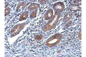 Image no. 1 for anti-Oxysterol Binding Protein 2 (OSBP2) (AA 596-835) antibody (ABIN1499917) (OSBP2 抗体  (AA 596-835))
