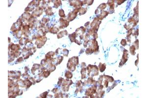 Immunohistochemistry (IHC) image for anti-Ornithine Decarboxylase 1 (ODC1) antibody (ABIN6940235)