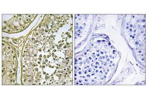 Immunohistochemistry analysis of paraffin-embedded human testis tissue, using CKI- alpha 1/L antibody. (CSNK1A1L 抗体  (Internal Region))