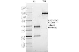 SDS-PAGE Analysis Purified Thyroid Peroxidase Mouse Monoclonal Antibody (TPO/1921). (TPO (AA 685-804) 抗体)