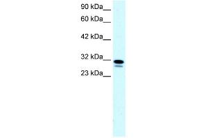 WB Suggested Anti-SSBP2 Antibody Titration: 0. (SSBP2 抗体  (N-Term))