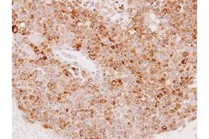 IHC-P Image Immunohistochemical analysis of paraffin-embedded OV90 xenograft, using UGT1A6, antibody at 1:100 dilution. (UGT1A6 抗体  (Center))