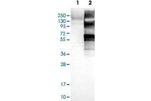 Western Blot analysis of Lane 1: negative control (vector only transfected HEK293T cell lysate) and Lane 2: over-expression lysate (co-expressed with a C-terminal myc-DDK tag in mammalian HEK293T cells) with USP20 polyclonal antibody .
