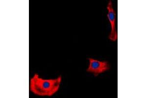 Immunofluorescent analysis of HER4 staining in HepG2 cells. (ERBB4 抗体  (C-Term))