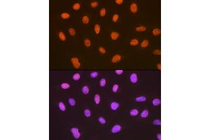 Immunofluorescence analysis of U-2 OS cells using SUMO4 Rabbit mAb (ABIN7270372) at dilution of 1:100 (40x lens). (SUMO4 抗体)