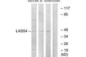 Western blot analysis of extracts from HuvEc/COLO/Jurkat cells, using LASS4 Antibody. (LASS4 抗体  (AA 41-90))