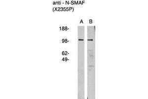 Image no. 1 for anti-Neutral Sphingomyelinase (N-SMase) Activation Associated Factor (NSMAF) antibody (ABIN793717)