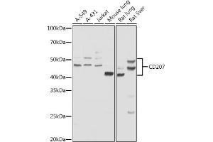 Western blot analysis of extracts of various cell lines, using CD207 antibody (ABIN6131544, ABIN6138141, ABIN6138142 and ABIN6222222) at 1:1000 dilution. (CD207 抗体  (AA 69-328))
