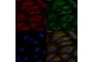 ABIN6265115 and ABIN6276896 staining  cells by IF/ICC. (SLC22A6 抗体  (C-Term))