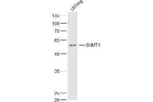 U87MG lysates probed with SHMT1 Polyclonal Antibody, Unconjugated  at 1:300 dilution and 4˚C overnight incubation. (SHMT1 抗体  (AA 301-400))