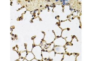 Immunohistochemistry of paraffin-embedded Mouse lung using IFI16 Polyclonal Antibody at dilution of 1:100 (40x lens). (IFI16 抗体)