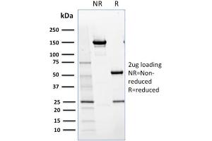 SDS-PAGE (SDS) image for anti-Nuclear Factor (erythroid-Derived 2)-Like 1 (NFE2L1) antibody (ABIN6940224)