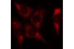 ABIN6278584 staining Hela cells by IF/ICC. (JTB 抗体  (Internal Region))