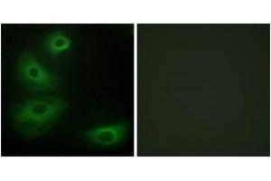 Immunofluorescence analysis of HeLa cells, using 5-HT-1B Antibody. (5HT1B Receptor 抗体  (AA 201-250))