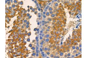 ABIN6258933 and ABIN6275175 at 1/100 staining Mouse testis tissue by IHC-P.