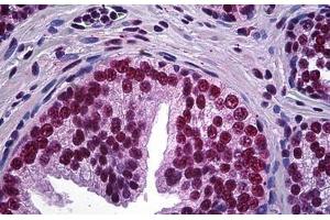 Human Prostate: Formalin-Fixed, Paraffin-Embedded (FFPE) (LHX4 抗体  (AA 291-390))