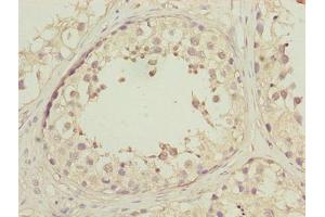 Immunohistochemistry (IHC) image for anti-DnaJ (Hsp40) Homolog, Subfamily B, Member 1 (DNAJB1) (AA 1-340) antibody (ABIN7150502)