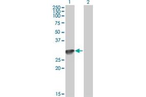 Western Blotting (WB) image for anti-Complement Component 1, Q Subcomponent, A Chain (C1QA) (AA 23-245) antibody (ABIN513848)