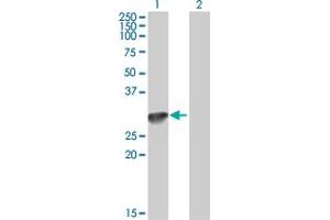 Western Blot analysis of C1QA expression in transfected 293T cell line by C1QA MaxPab polyclonal antibody. (C1QA 抗体  (AA 23-245))