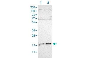 Western Blot (Cell lysate) analysis of (1) Human RT-4 cell and (2) Human U-251MG sp cell. (UBE2G2 抗体)
