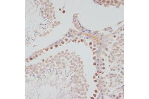 Immunohistochemistry of paraffin-embedded rat testis using Cyclin G1 antibody (ABIN6127734, ABIN6138095, ABIN6138096 and ABIN6220906) at dilution of 1:100 (40x lens). (Cyclin G1 抗体  (C-Term))