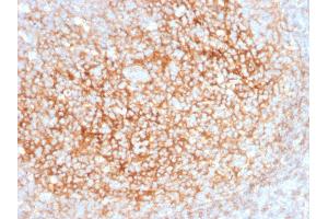 Immunohistochemistry (IHC) image for anti-5'-Nucleotidase, Ecto (CD73) (NT5E) antibody (ABIN6940229)
